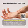 How Canada’s University Health Network Is Helping Stroke and Spinal Cord Injury Patients Regain Hand Movements Using Functional Electrical Stimulation (FES)